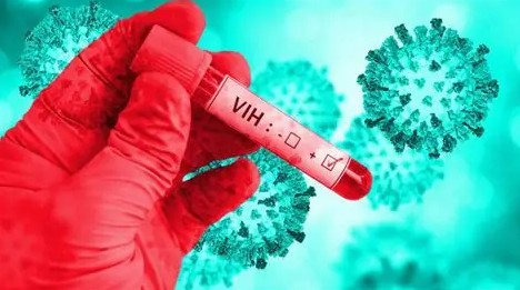 Pasaron de cuatro a 15 casos de VIH: Salud