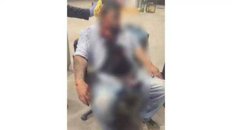 Golpeado con un tubo, Convivio termina en sangrienta riña en Waterfill; pidió ayuda en una gasolinera